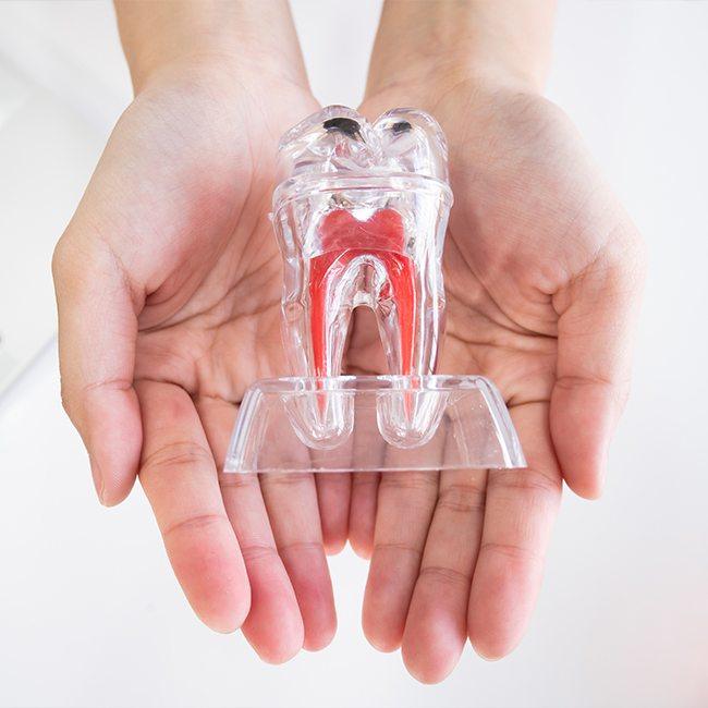 Model of the inside of a tooth