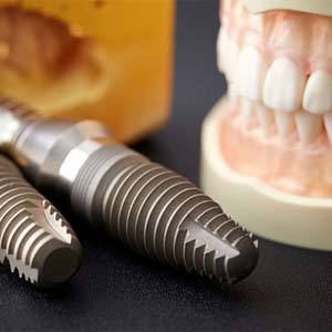 closeup of dental implants that have antibacterial coating