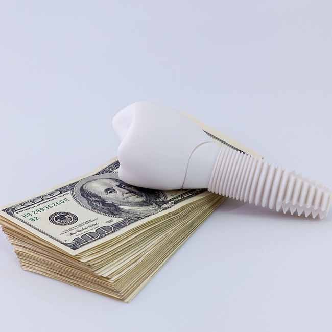 Implant on money representing cost of dental implants in Los Angeles