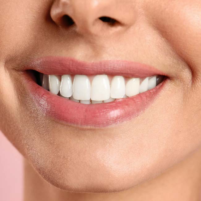 Smile and benefits of dental implants in Los Angeles