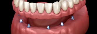 Animated tooth with bubbles